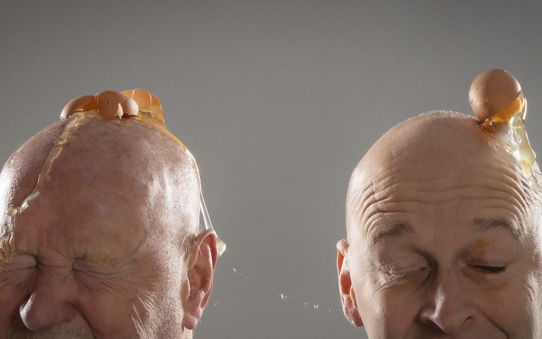 Wow #2 – Crâne d’Oeuf